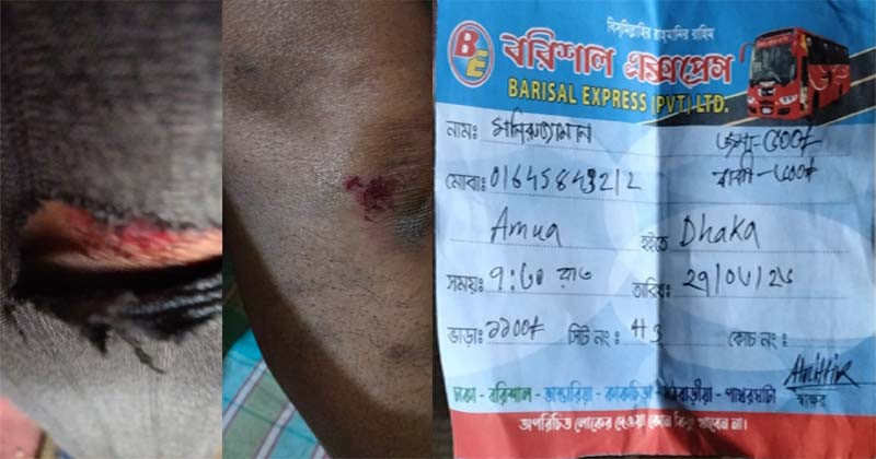 চলন্ত বাস থেকে যাত্রীকে ফেলে দিল ‘বরিশাল এক্সপ্রেস’, ভাড়া নিয়ে নৈরাজ্য
