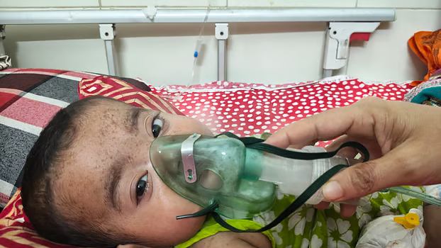 ময়মনসিংহ মেডিকেলে হামের লক্ষণ নিয়ে ভর্তি আরও ২২ শিশু