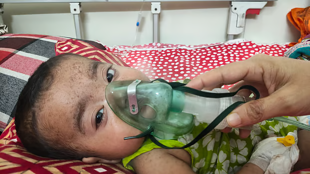ময়মনসিংহ মেডিকেলে হামের লক্ষণ নিয়ে আরও ২৮ শিশু ভর্তি
