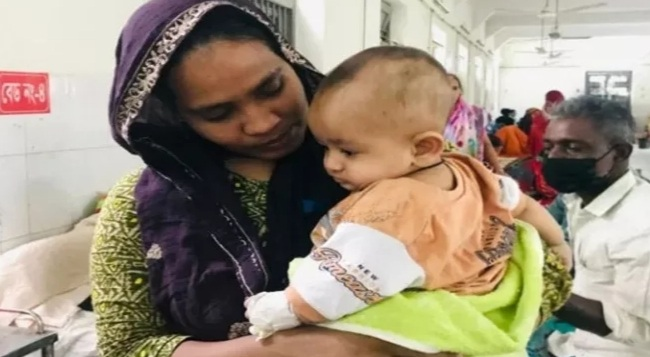 সিলেটে হামের উপসর্গে আরও ২ শিশুর মৃত্যু